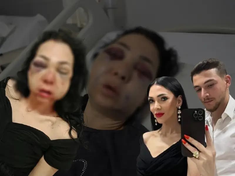 Kocaeli'de Bayram Kafesinde Kanlı Saldırı: Anne ve Oğul Hedefte